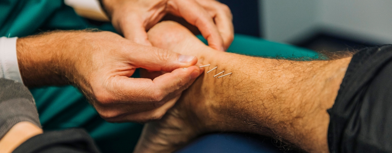 physical-therapy-clinic-dry-needling-the-smith-clinic-for-physical-therapy-cordova-tn